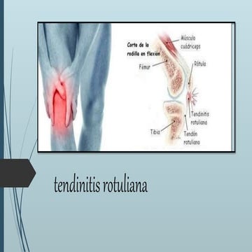 tendinitis rotuliana.pptx