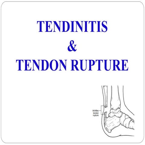 Tendinitis & Tendon rupture and tendinosis | PDF