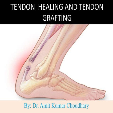 Tendon  healing and tendon grafting