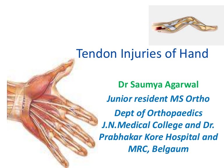 Tendon injuries of hand by Dr Saumya Agarwal