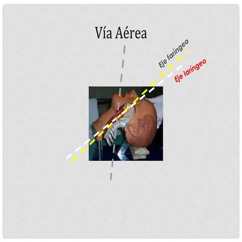 Teorico_VIA_AEREA.pptx