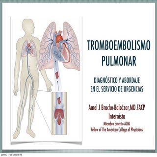 Tromboembolismo Pulmonar 2015