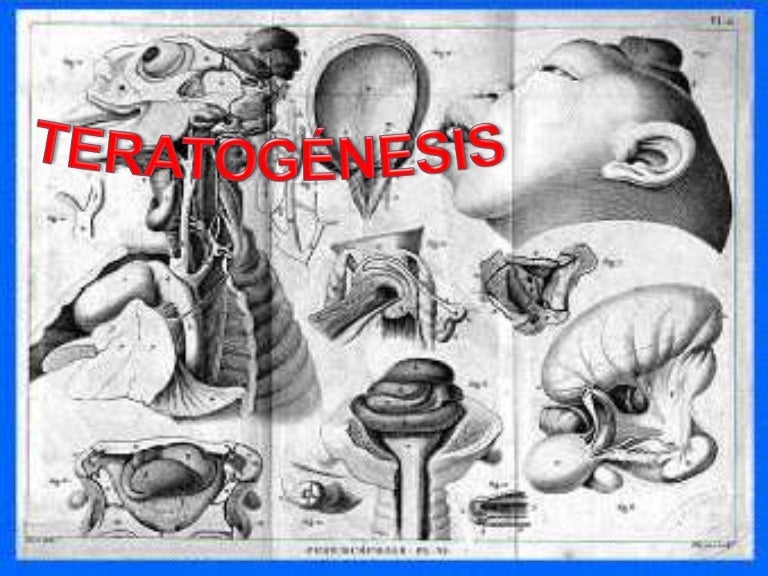 Teratogénesis