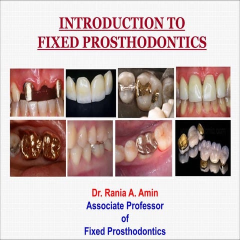 recent library dissertation topics in prosthodontics