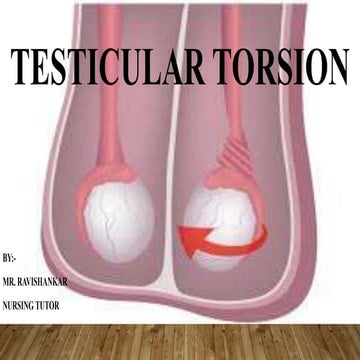 Testicular torsion.pptx
