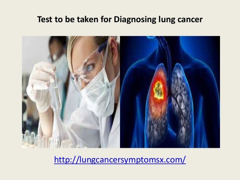 Test to be Taken for Symptoms of Lung cancer