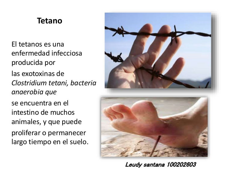 Que Es El Tetano Images and Photos finder