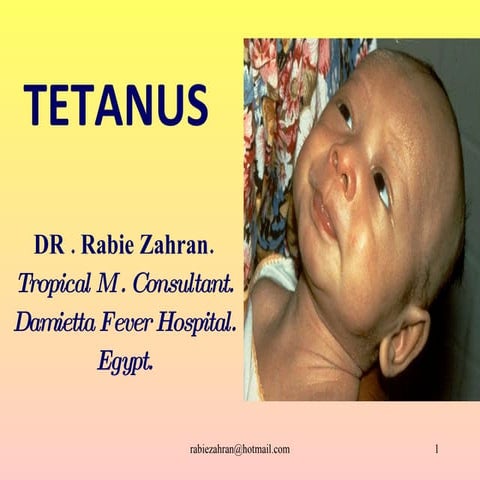 Tetanus Presentation | PPT