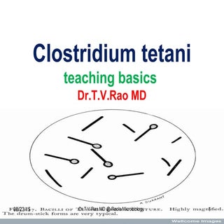 Tetanus Teaching basics 