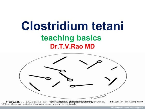 Clostridium tetani | PPT