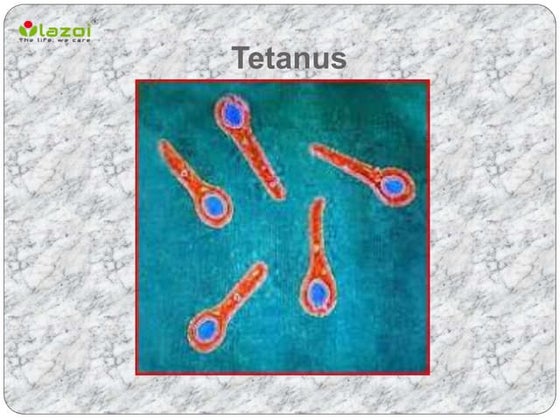 Tetanus Bacteria Labeled