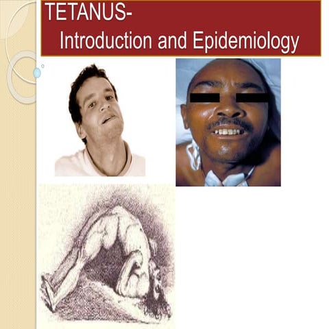 Tetanus- Introduction and Its epidemiology in Nepal | PPTX