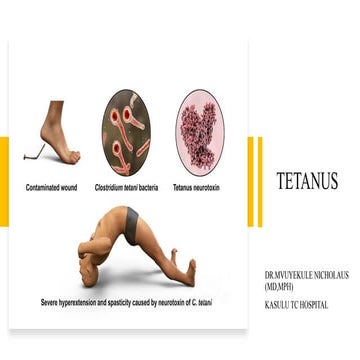 Tetanus | PPTX