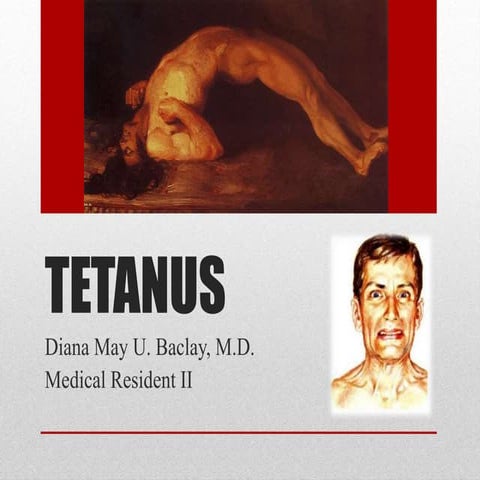 Tetanus discussion