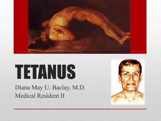 Tetanus | PPT