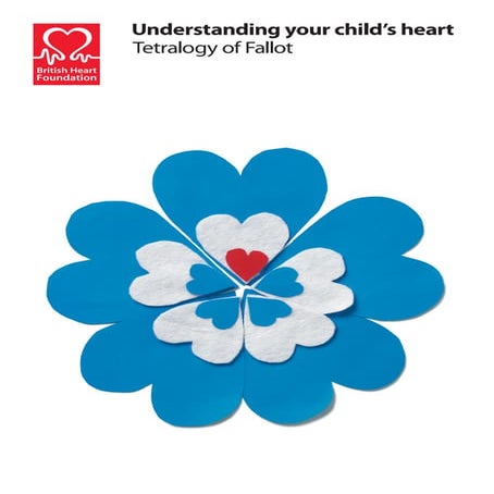 Tetralogy-Of-Fallot parent guide pediatrics