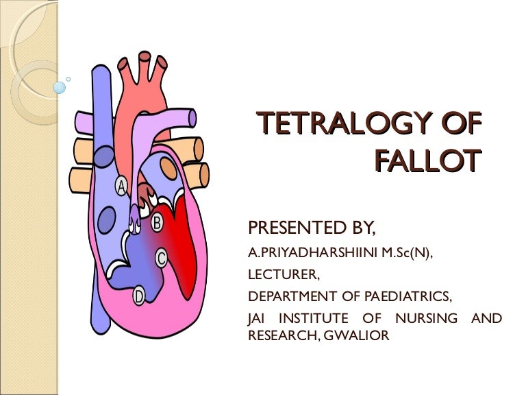 Tetralogy Of Fallot
