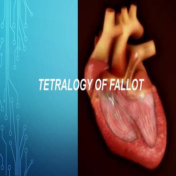 Tetraology of fallot copy 3
