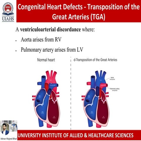 Overview of Neonatal Hemodynamic Transition | PPTX