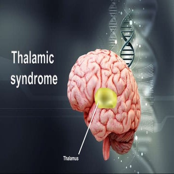 Thalamic syndrome