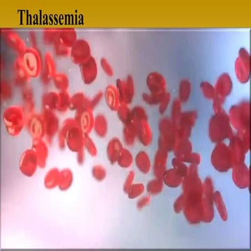 Thalassemia sanjay.pptx