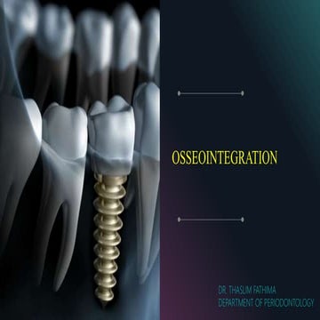 Osseointegration