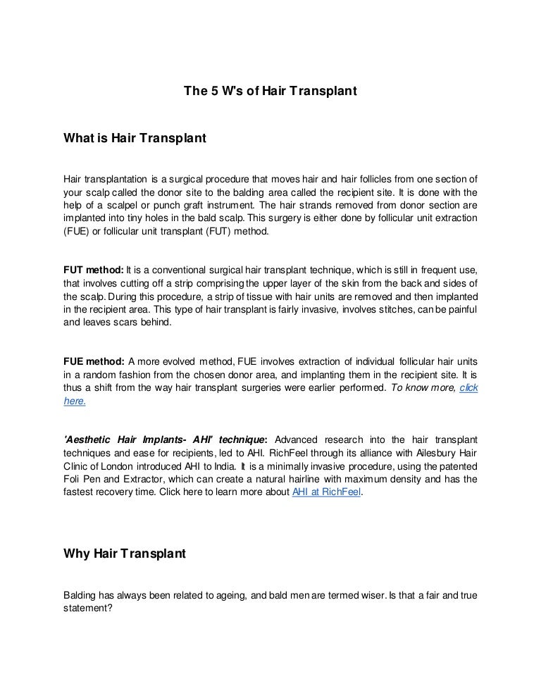 The 5 W S Of Hair Transplant
