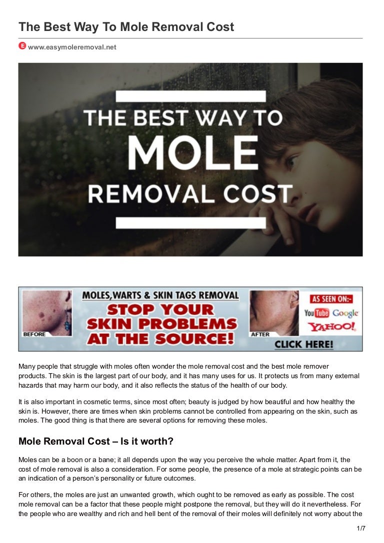 The best way to mole removal cost
