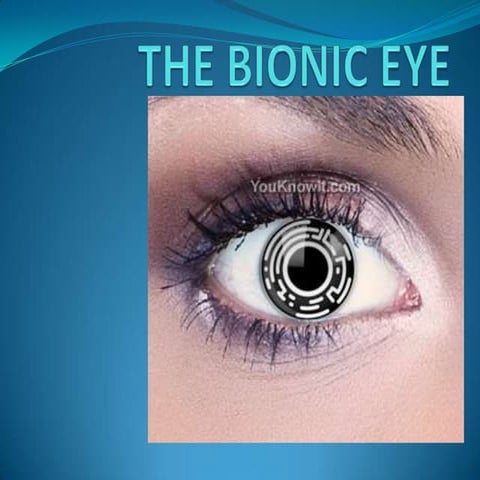 The bionic eye