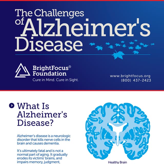 The Challenges of Alzheimer's | PDF