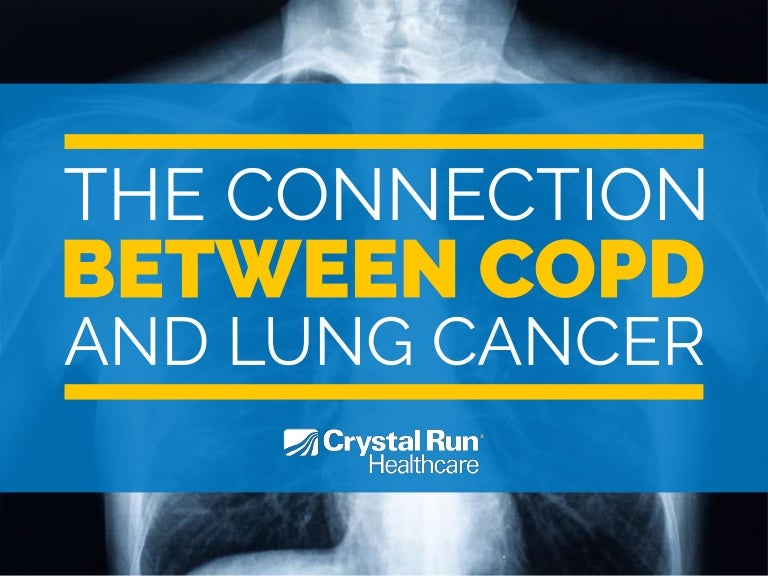 The Connection Between COPD and Lung Cancer