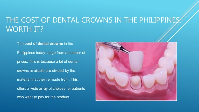 The Cost Of Dental Crowns In The Philippines