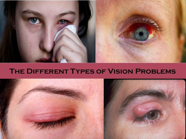 The different types of vision problems
