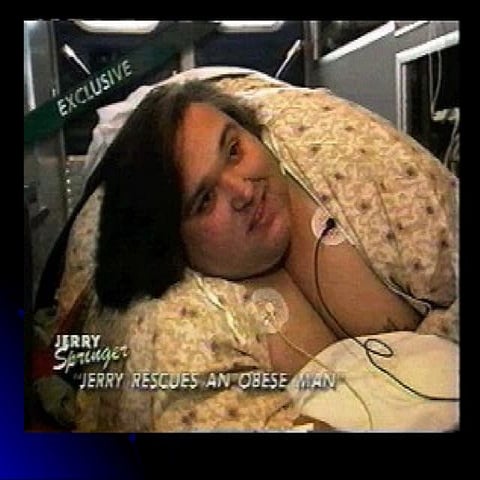 The ‘difficult’ airway