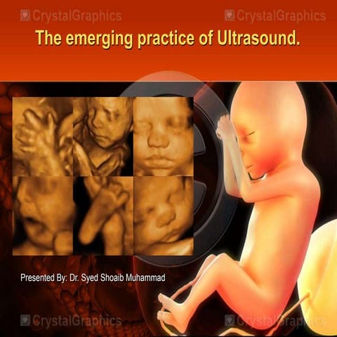 3D and 4D ultrasound in obstetrics | PPTX