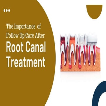 The Importance of Follow-Up Care After Root Canal Treatment | PPTX