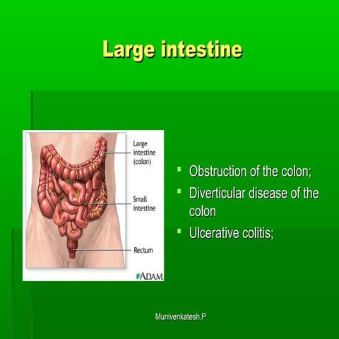 The large intestine | PPT