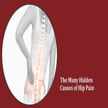 The many hidden causes of hip pain