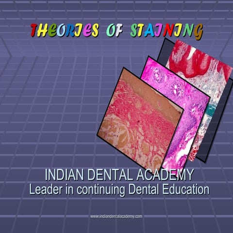 Theories of staining (2) / dental implant courses by Indian dental academy 