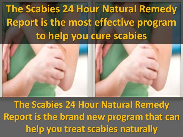 The Scabies 24 Hour Natural Remedy Report is the most effective progr…