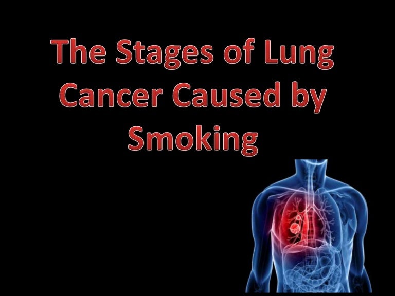 smoking causes lung cancer essay