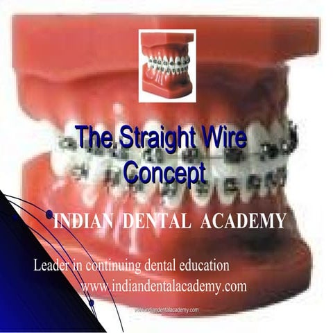 The straight wire concept  /certified fixed orthodontic courses by Indian den...