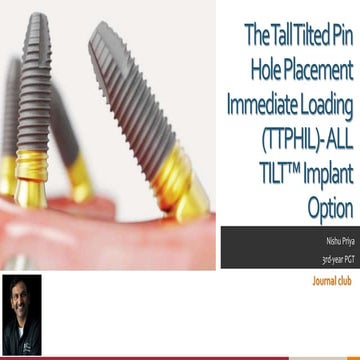 The Tall Tilted Pin Hole Placement Immediate Loading.pptx