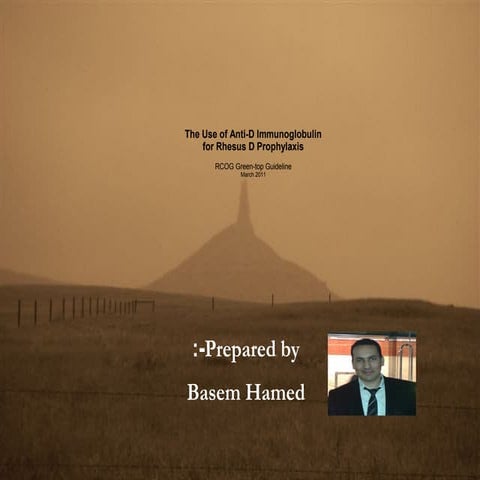 The use of anti D (rcog guidelines)