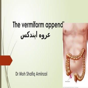 Trichobezoar_Presentation dr Shafiq.pptx