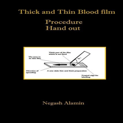 Thick and thin blood smear Procedure
