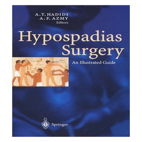 Hypospadias 3: MAGPI & snod grass (TIP) step by step operative urology ...