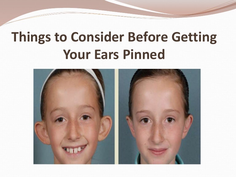 Things to Consider Before Getting Your Ears Pinned