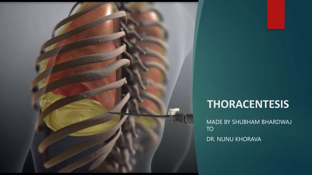 Thoracentesis | PPTX
