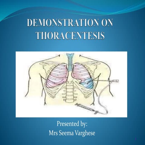 Thoracocentesis | PPTX
